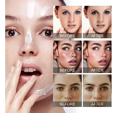 Crema Para Manchas Oscuras En La Cara, Cremas Para Quitar