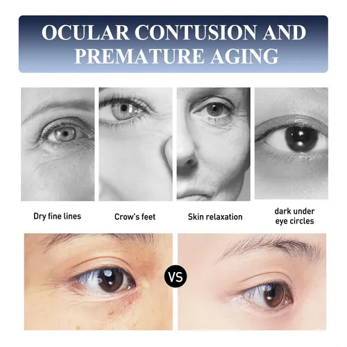 Crema Instantánea Antiarrugas Para Ojos Jaysuing, Reafirmant Madura Día/noche