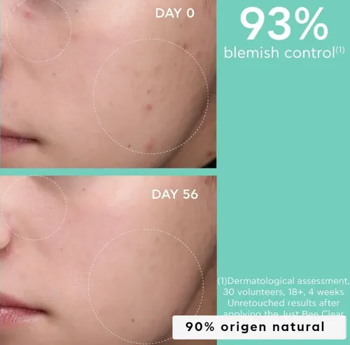Apivita Locion Matificante Control Acne Just Bee Clear 40 Ml