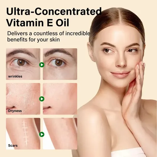 D2260630-4-4 Aceite Vitamina E Natural 75,000 Iu Para