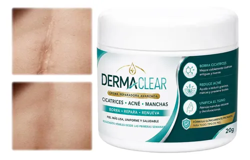 Crema Reparadora Suaviza Textura Acné Manchas Cicatrices