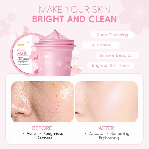 Mascarilla De Lodo Sakura Fenyi 100g – Limpieza De Poros