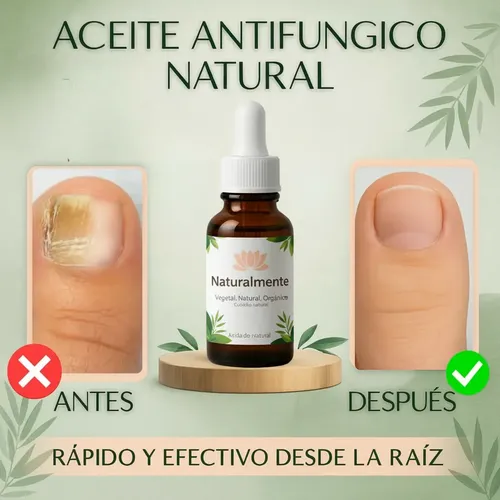 Aceite Antihongos 2×1 Para Pies Uñas Y Manos