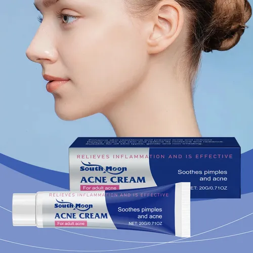 Crema Herbal Para Aliviar El Acné De South Moon, De Cuidado