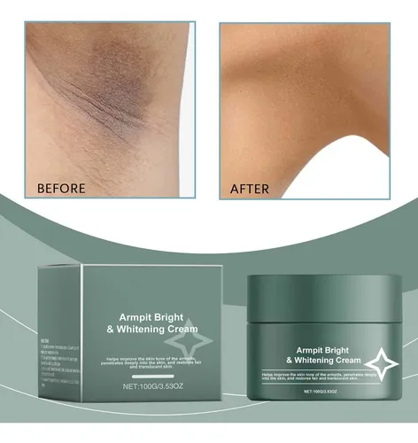 La Crema Para Axilas Elimina Las Manchas Oscuras, Blanquea L