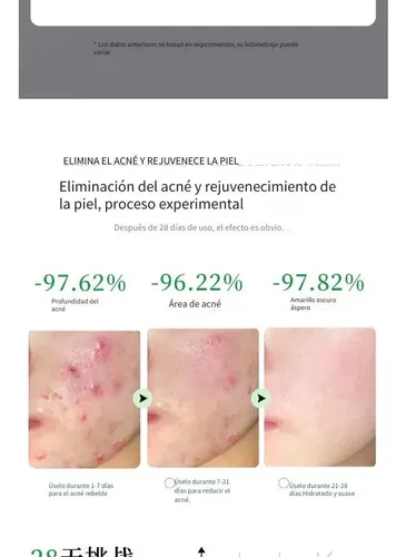 Wzk Crema Antiacné For Piel Grasa 20g Ebug Todo Tipo De Q