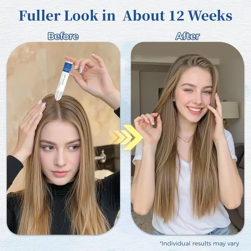 Sérum Para El Crecimiento Del Cabello Roll-on Gluvelessia 25
