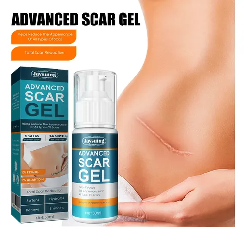 Crema En Gel Para El Cuidado De La Piel Para Una Piel Suave,