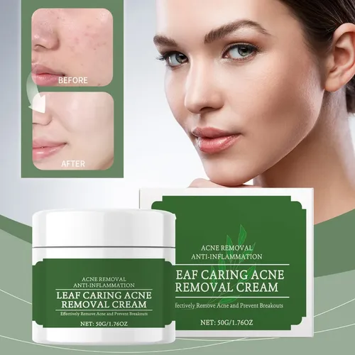 Crema Calmante Para El Acné Que Hidrata Y Mejora La Piel