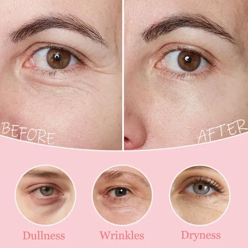 80 Parches Para Los Ojos Con Colágeno Debajo De Los Ojos, Ma
