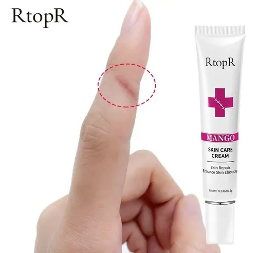 Gel Para Cicatrices Manchas Quemaduras Estrias Acne Crema