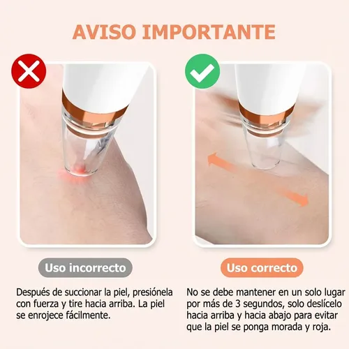 Extractor Puntos Negros Espinillas Removedor Limpiador Usb