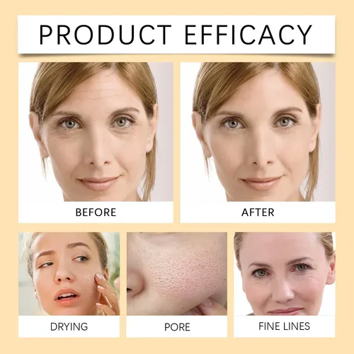 Jabón De Limón Y Cúrcuma Kójico Iluminador Facial Y H