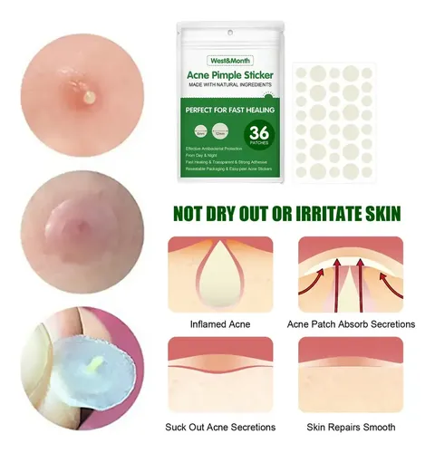 Parche Impermeable Para El Acné Que Absorbe Las Espinillas,