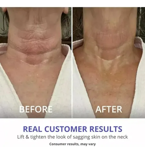 (vip) // Crema Reafirmante De Cuello Gopure 1pcs A