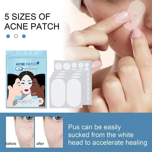 Patch Ii Pimple Acne De Tamaño Grande, 80 Unidades/juego