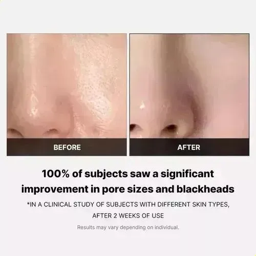 Któnico En Paños Zero Pore Pads 2.0 Pdh //