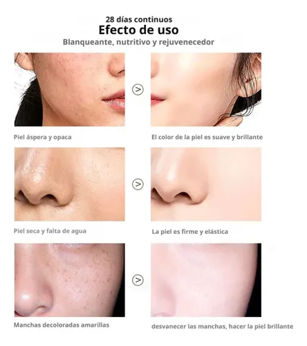 Crema Blanqueadora Para Manchas Oscuras, Antipecas,