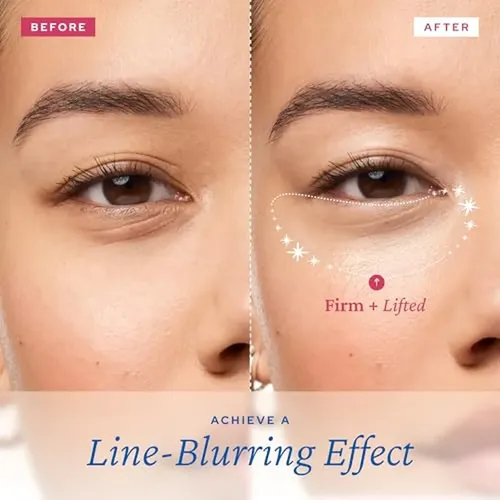 Sérum Reafirmante Para Ojos Belif Con Retinol Aqua Bomb, Gel