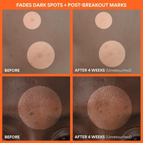 Crema Iluminadora de Vitamina C Innisfree para Rostro con FPS 36