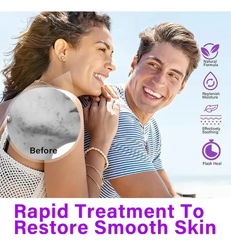 Crema Ácida: Crema Facial Hidratante Y No Pegajosa Para Una