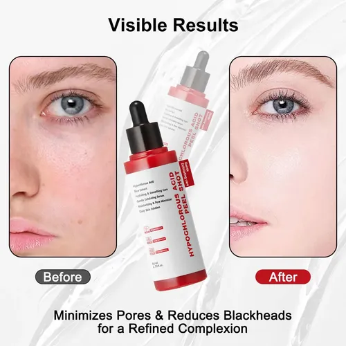Gentle Exfoliating Serum With Hypochlorous Acid & Rice
