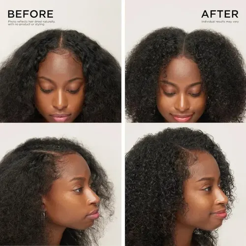 Serum Espesante Para El Cabello, Ganador Del Premio Tt
