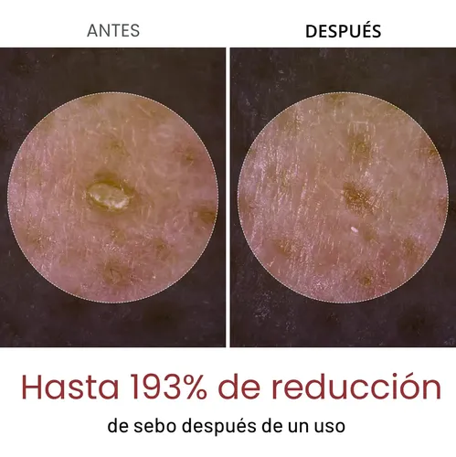 Ampolla Exfoliante Iluminadora Dr.melaxin Pelling Arroz 80ml