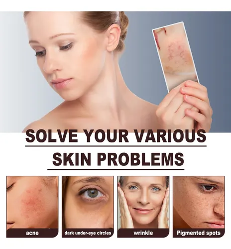 El Exfoliante De Café Jaysuing Limpia Suavemente Las Células