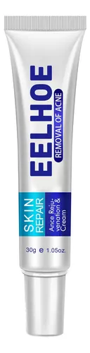 Crema Para El Acné Eelhoe: Disminuye Las Imperfecciones Y Eq