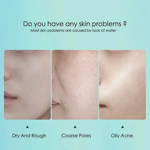 Mascarilla Acido Hialuronico Hidratante Poros 10 Pzs