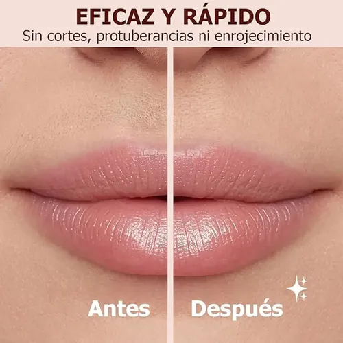Y Depiladora Eléctrica 4 En 1 Gitifo For Mujer Con 4