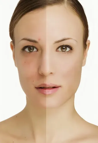 Idraet Mascara Peeling Enzimatica Nutritiva Blanqueadora