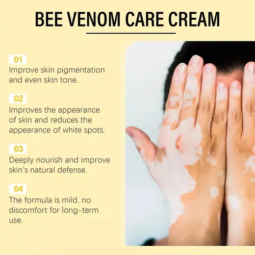 Crema Para El Cuidado Y Reparación De Manchas Blancas Para E