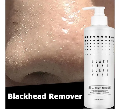 Blackhead Exporting Small Bubble Device Liquid With Ii