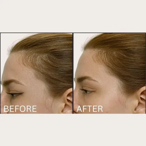 Cepillo Estimulante Para El Cabello Solaris Laboratories Ny