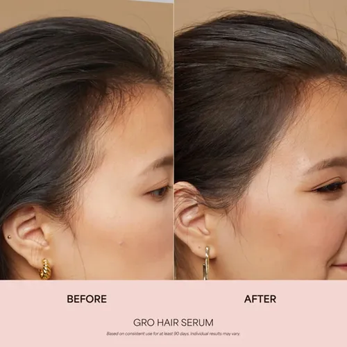 Serum Capilar Vegamour Gro 100 Ml Para Un Cabello Más Grueso