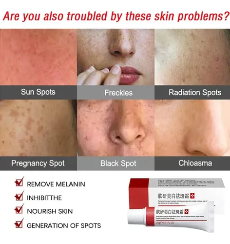 C Elimina Las Manchas Faciales: Melasma, Pecas, Qcc
