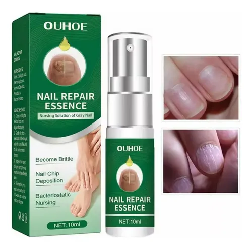 Suero Reparacion Uñas Ataca Hongos Onicomicosis 100% Calidad