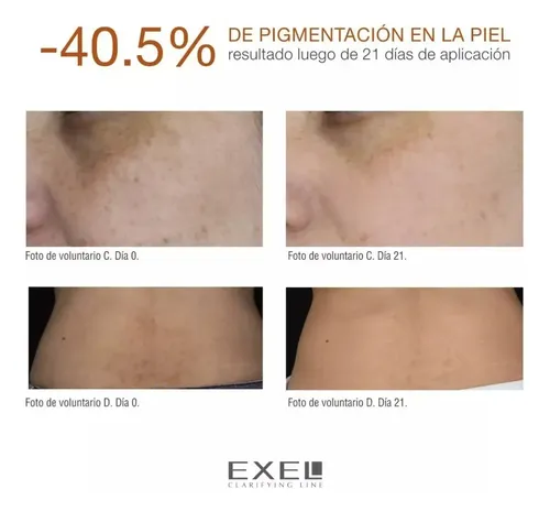 Exel Crema Clarificante Liposomas Por 30ml Aclara Manchas.