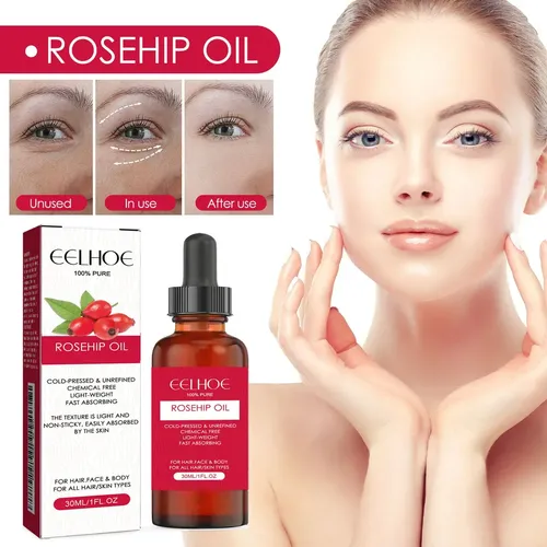 Aceite Facial Rosa Mosqueta Hidratante Repara Piel
