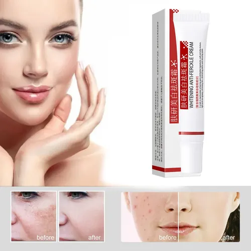 Útil Crema Blanqueadora Y Antipecas, Hidratante Y Antiarruga