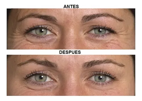 Idraet Contorno Ojos Sublime Eyes Antiarrugas Bolsas Ojeras