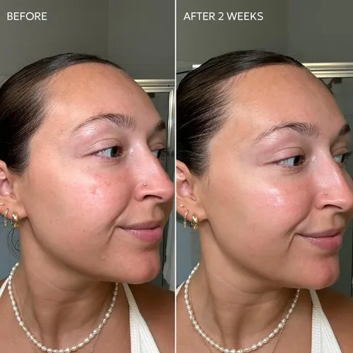 Fycrema Correctora De Manchas Oscuras Dermisa Skin Fade Con