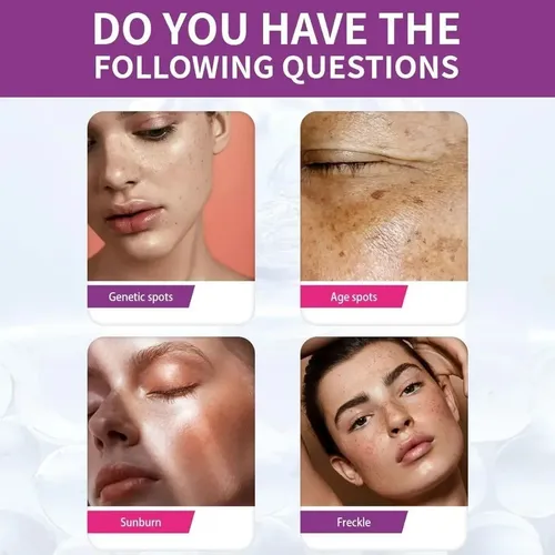 3*crema Urea Antimancha, Eliminación Reducir Manchas Oscuras