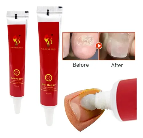 Crema Reparadora De Uñas Generic – Tubo 75ml