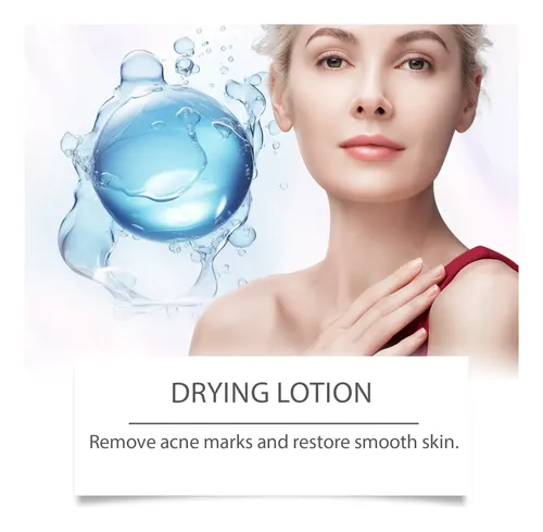 Amz Crema Para El Cuidado De La Piel Con Acné, Hidratante Y