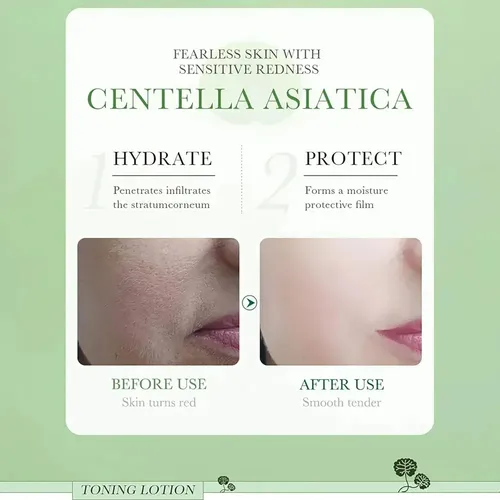 Tónico Facial Centella Asiática Bioaqua Antiacne Todo Tipo De Piel Día/noche