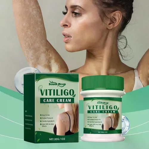 La Crema New Z Para El Vitíligo Reduce Las Manchas Blancas.