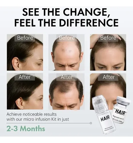 Exquisite Micro Infusion Hair System Premium Care